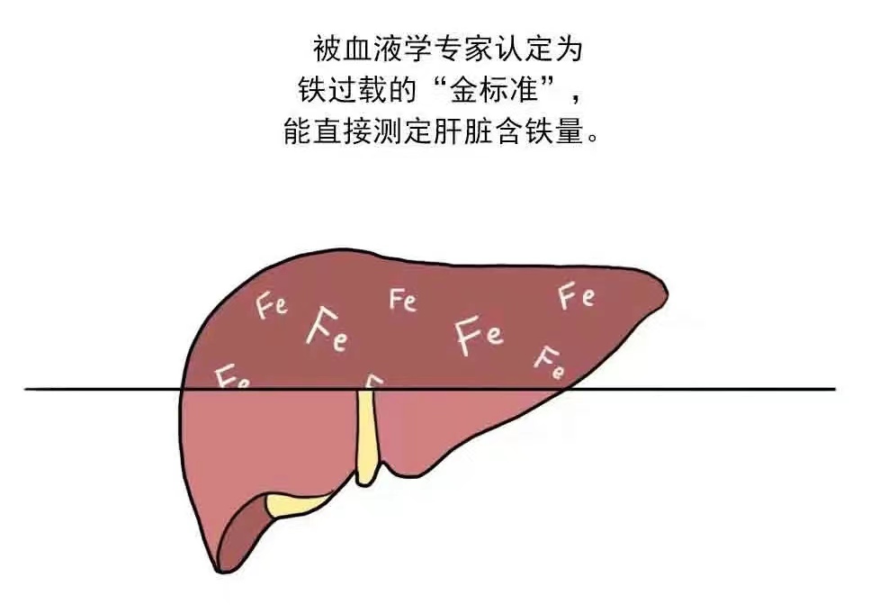 骨髓增生異常綜合征(MDS)鐵過載的檢查方法