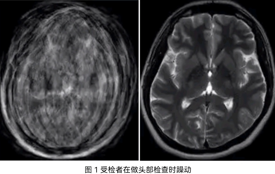 影像科 新技術(shù)臨床應(yīng)用周刊第8季