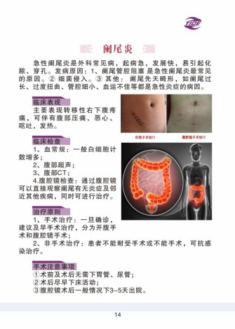 普外科加速康復外科手冊_14.jpg