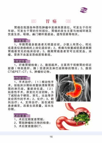 普外科加速康復外科手冊_16.jpg