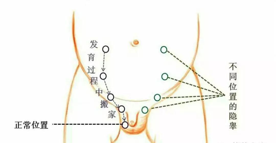 過(guò)程.jpg