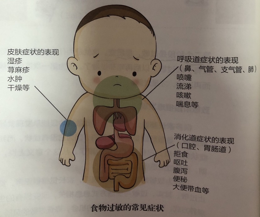 過敏1.jpg